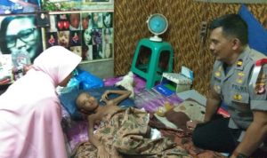 Erna Sari (12) Mengalami Kelainan Usus