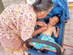 Seorang warga di Indramayu alami gizi buruk