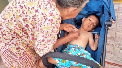Seorang warga di Indramayu alami gizi buruk
