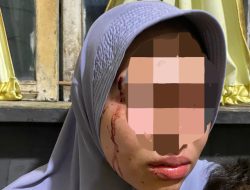Korban KDRT Berharap Pelaku Segera Diamankan Polres Madina