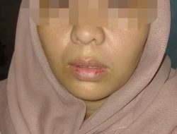 Andi Candra Minta Kasus Pengeroyokan Kliennya Segera Ditanggapi, Polres Madina Masih Bekerja