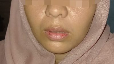 Andi Candra Minta Kasus Pengeroyokan Kliennya Segera Ditanggapi, Polres Madina Masih Bekerja