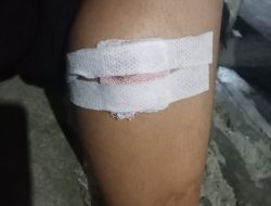 Korban Kecelakaan Kecewa, Dinas PUPR Madina Tidak Ada Perhatian