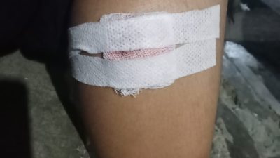 Korban Kecelakaan Kecewa, Dinas PUPR Madina Tidak Ada Perhatian