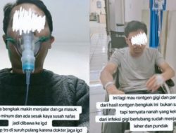 Meninggal Dunia Akibat Gigi Berlubang: Pengingat Pentingnya Jaga Kesehatan Gigi