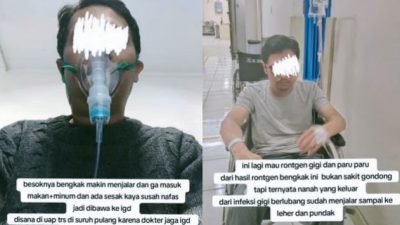 Meninggal Dunia Akibat Gigi Berlubang: Pengingat Pentingnya Jaga Kesehatan Gigi
