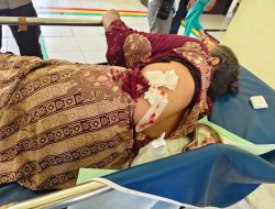 Teror Kera Liar di Tembilahan: 18 Warga Jadi Korban Ganas, Punggung Robek hingga 12 Jahitan!
