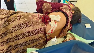Teror Kera Liar di Tembilahan: 18 Warga Jadi Korban Ganas, Punggung Robek hingga 12 Jahitan!